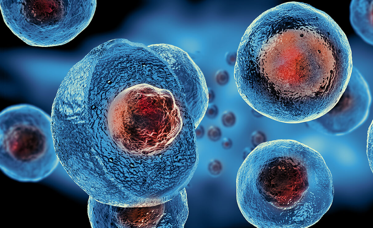 Study: Stem Cell Injections Could End Diabetic Amputations